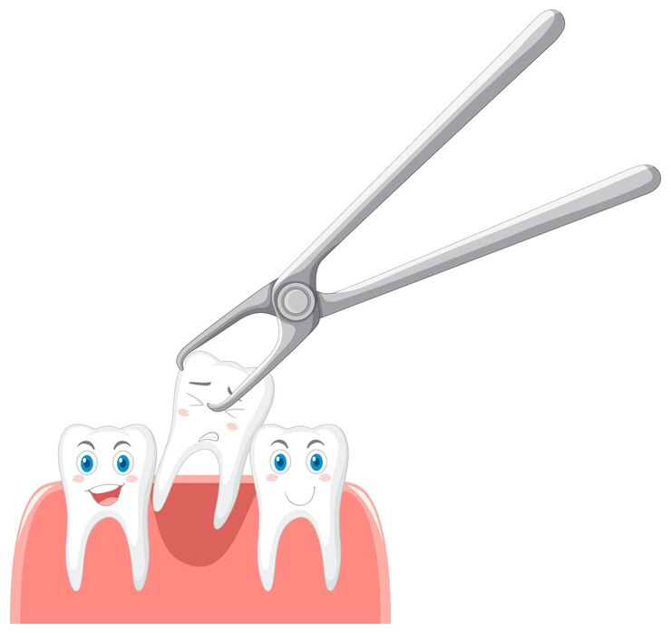 Tooth Extraction